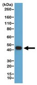 Anti-beta-Actin Antibody, clone RM112 clone RM112, from rabbit