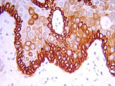 抗细胞角蛋白19抗体（克隆RCK108） clone RCK108, Chemicon®, from mouse