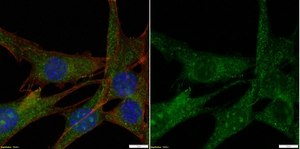 抗分区缺陷3抗体 Upstate®, from rabbit