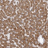 Anti-CPT2 antibody produced in rabbit Prestige Antibodies® Powered by Atlas Antibodies, affinity isolated antibody, buffered aqueous glycerol solution, ab2