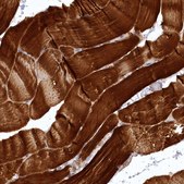 Anti-SYNPO2 antibody produced in rabbit Prestige Antibodies® Powered by Atlas Antibodies, affinity isolated antibody, buffered aqueous glycerol solution