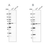 Anti-SHMT2 antibody produced in rabbit Prestige Antibodies® Powered by Atlas Antibodies, affinity isolated antibody, buffered aqueous glycerol solution, Ab2