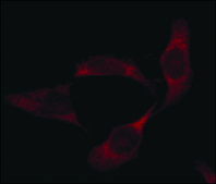 Anti-Superoxide Dismutase (MnSOD) (DD-17)−Cy3 antibody produced in rabbit 1-2 mg/mL, affinity isolated antibody, buffered aqueous solution