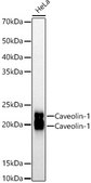 Anti-Caveolin-1 Antibody, clone 10Y5L2, Rabbit Monoclonal