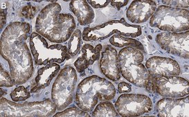 Anti-Spectrin α Antibody, clone 2G17 ZooMAb® Rabbit Monoclonal recombinant, expressed in HEK 293 cells