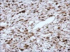 Anti-HMGA2 antibody produced in rabbit