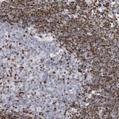 Anti-MECP2 antibody produced in rabbit Ab2, Prestige Antibodies® Powered by Atlas Antibodies, affinity isolated antibody, buffered aqueous glycerol solution