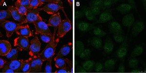 Anti-Notch1 Antibody, clone 1A32 ZooMAb® Rabbit Monoclonal recombinant, expressed in HEK 293 cells