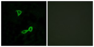 Anti-GRM2 antibody produced in rabbit affinity isolated antibody