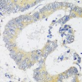 Anti-SNAIL antibody produced in rabbit