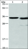 Anti-CTSL antibody produced in rabbit affinity isolated antibody