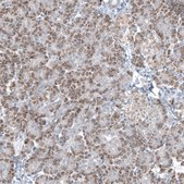 Monoclonal Anti-GLS2 antibody produced in mouse Prestige Antibodies® Powered by Atlas Antibodies, clone CL7716, purified immunoglobulin, buffered aqueous glycerol solution