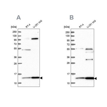 Anti-TRMT112 antibody produced in rabbit Prestige Antibodies® Powered by Atlas Antibodies, affinity isolated antibody, buffered aqueous glycerol solution