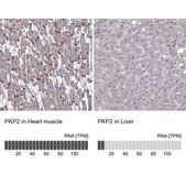 Anti-PKP2 antibody produced in rabbit Prestige Antibodies® Powered by Atlas Antibodies, affinity isolated antibody