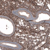 抗-COL1A1 兔抗 Prestige Antibodies® Powered by Atlas Antibodies, affinity isolated antibody, buffered aqueous glycerol solution