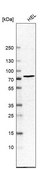 Anti-CHEK2 antibody produced in rabbit Prestige Antibodies® Powered by Atlas Antibodies, affinity isolated antibody, buffered aqueous glycerol solution