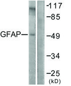 Anti-GFAP antibody produced in rabbit affinity isolated antibody