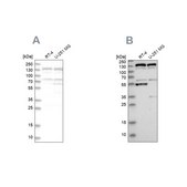 Anti-GOLGA2 antibody produced in rabbit Prestige Antibodies® Powered by Atlas Antibodies, affinity isolated antibody, buffered aqueous glycerol solution, Ab2