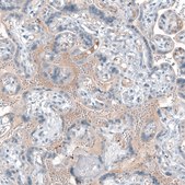 Anti-CXCL8 antibody produced in rabbit Prestige Antibodies® Powered by Atlas Antibodies, affinity isolated antibody, buffered aqueous glycerol solution