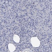 Anti-ANXA6 antibody produced in rabbit Ab1, Prestige Antibodies® Powered by Atlas Antibodies, affinity isolated antibody, buffered aqueous glycerol solution