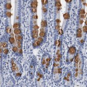 Anti-GNAS antibody produced in rabbit Prestige Antibodies® Powered by Atlas Antibodies, affinity isolated antibody, buffered aqueous glycerol solution