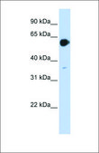Anti-RARA antibody produced in rabbit affinity isolated antibody