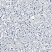 Anti-DLG4 antibody produced in rabbit Prestige Antibodies® Powered by Atlas Antibodies, affinity isolated antibody, buffered aqueous glycerol solution