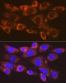Anti-ARF1 Antibody, clone 0C5B3, Rabbit Monoclonal