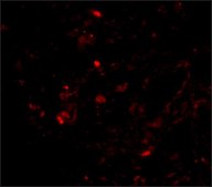 Anti-Transthyretin antibody produced in chicken affinity isolated antibody, buffered aqueous solution