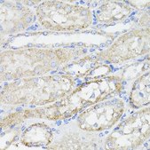 Anti-Caspase 8 antibody produced in rabbit