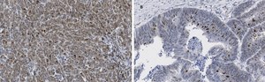Anti-phospho-Smad2 (Ser465/467) Antibody, clone A5S, ZooMAb® Rabbit Monoclonal recombinant, expressed in HEK 293 cells
