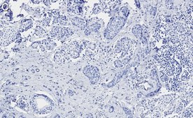 Anti-Phospho-ACC1-(Ser79) Antibody, clone 1E11 ZooMAb® Rabbit Monoclonal recombinant, expressed in HEK 293 cells