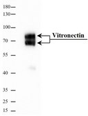 Vitronectin human recombinant, expressed in HEK 293 cells, ≥95% (SDS-PAGE), ≥95% (HPLC), suitable for cell culture