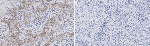 Anti-Integrin αVβ3 Antibody, clone EM22703 ZooMAb® Rabbit Monoclonal recombinant, expressed in HEK 293 cells