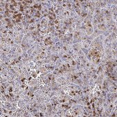 Anti-MYO1F antibody produced in rabbit Prestige Antibodies® Powered by Atlas Antibodies, affinity isolated antibody, buffered aqueous glycerol solution