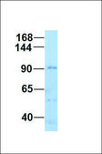 Anti-AR antibody produced in rabbit affinity isolated antibody