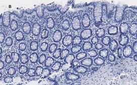 Anti-trimethyl-Histone H3 (Lys4) Antibody, clone MC315, ZooMAb® Rabbit Monoclonal recombinant, expressed in HEK 293 cells