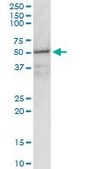 Monoclonal Anti-GNAI1 antibody produced in mouse clone 2B8-2A5, purified immunoglobulin, buffered aqueous solution