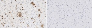 Anti-Amyloid β42/40 Antibody, clone W0-2 ZooMAb® Mouse Monoclonal recombinant, expressed in HEK 293 cells