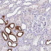 Anti-SLC12A3 antibody produced in rabbit Prestige Antibodies® Powered by Atlas Antibodies, affinity isolated antibody, buffered aqueous glycerol solution