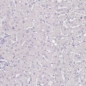 Anti-IL18BP antibody produced in rabbit Prestige Antibodies® Powered by Atlas Antibodies, affinity isolated antibody, buffered aqueous glycerol solution