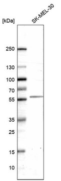 Monoclonal Anti-Htr2B Antibody Produced In Mouse Prestige Antibodies® Powered by Atlas Antibodies, clone CL14576, affinity isolated antibody, buffered aqueous glycerol solution