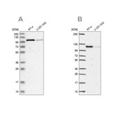 Anti-PRKD2 antibody produced in rabbit Prestige Antibodies® Powered by Atlas Antibodies, affinity isolated antibody, buffered aqueous glycerol solution