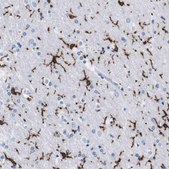 抗-P2RY12 兔抗 Prestige Antibodies® Powered by Atlas Antibodies, affinity isolated antibody, buffered aqueous glycerol solution