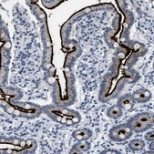 Anti-KCNC3 antibody produced in rabbit Prestige Antibodies® Powered by Atlas Antibodies, affinity isolated antibody, buffered aqueous glycerol solution