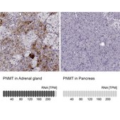 Anti-PNMT antibody produced in rabbit Prestige Antibodies® Powered by Atlas Antibodies, affinity isolated antibody, buffered aqueous glycerol solution