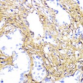 Anti-COL1A1 antibody produced in rabbit