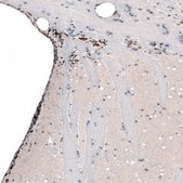 Monoclonal Anti-POU3F2 antibody produced in mouse Prestige Antibodies® Powered by Atlas Antibodies, clone CL6232, purified immunoglobulin, buffered aqueous glycerol solution