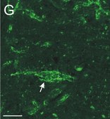 Anti-Chondroitin Sulfate Proteoglycan Antibody, Brain (core protein), clone Cat-301 clone Cat-301, Chemicon®, from mouse
