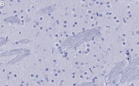 Anti-mGluR5 Antibody, clone 1F11 ZooMAb® Rabbit Monoclonal recombinant, expressed in HEK 293 cells